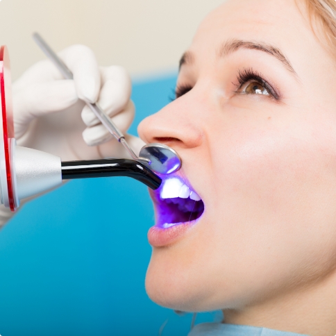 Woman receiving Bioclear dental bonding from her cosmetic dentist in Weatherford