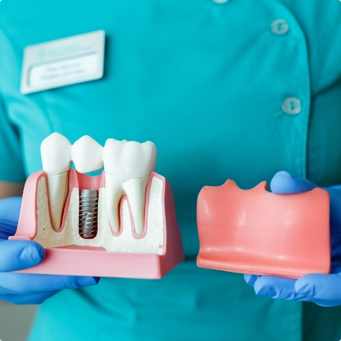 Dentist holding model of gums with a dental implant