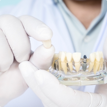 Dentist with dental crown in one hand and model of jaw with dental implant in the other