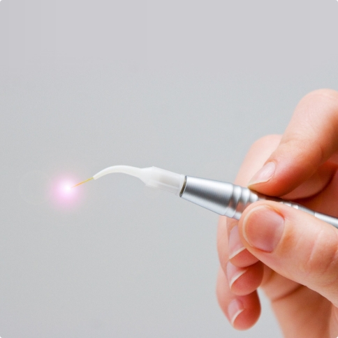 Hand holding dental soft tissue laser