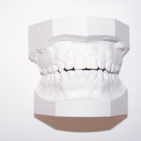 White model of the teeth