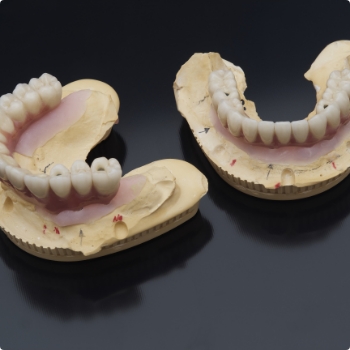 Two models of dentures on table