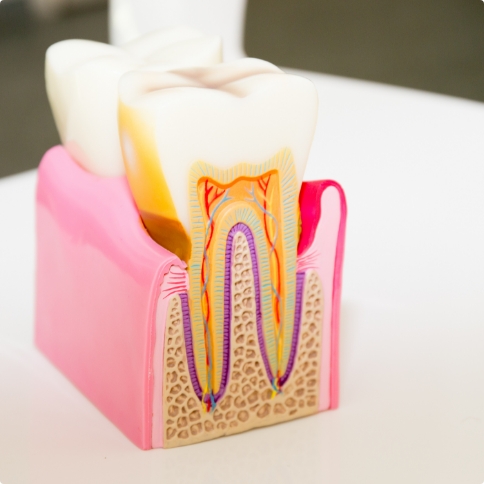 Model of a tooth within the gums