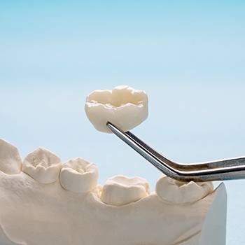 a model of a dental crown 