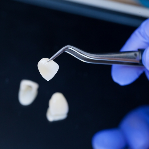 Dentist using tweezers to hold metal free dental restoration in Weatherford