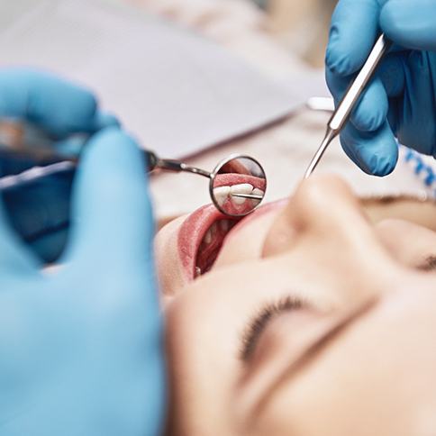 A woman’s teeth and gums reflected with mirror during examination