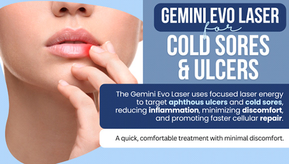 Graphic of how Gemini can treat cold sores