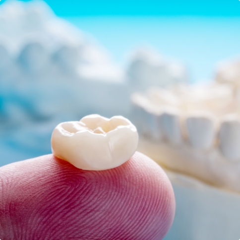 Dental crown resting on a finger