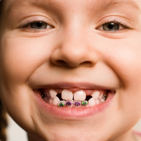 Close up of smiling child with traditional braces in Weatherford on their lower teeth